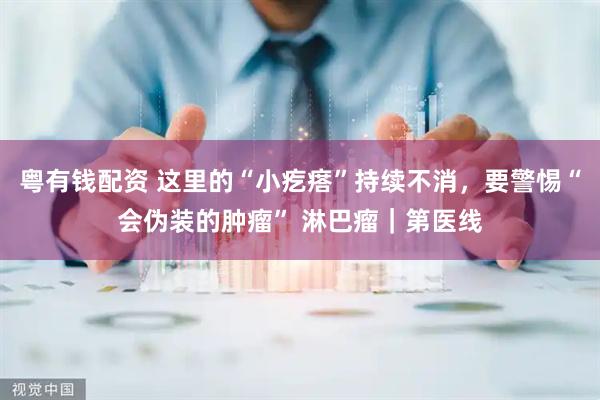 粤有钱配资 这里的“小疙瘩”持续不消，要警惕“会伪装的肿瘤” 淋巴瘤｜第医线